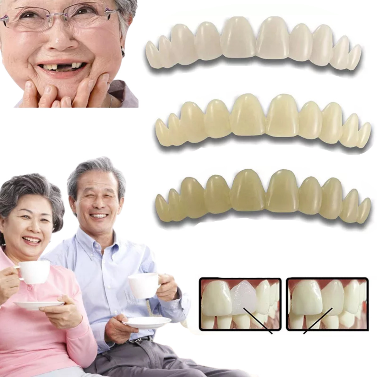 Dientes Postizos Temporal Sonrisa Dental Carilla Estetica