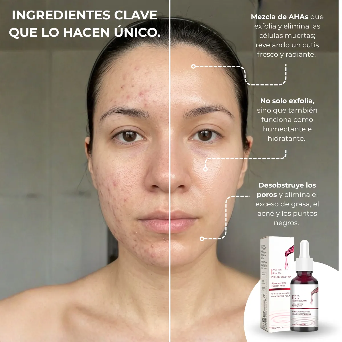 Sérum Exfoliante Facial Aha 30% + Bha 2% - Imagen 4